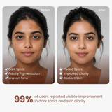 2% Kojic Acid Serum Cream for Dark Spots and Pigmentation - 30gm