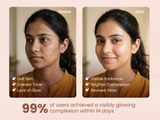 Bodytales 2% Kojic Acid Brightening Combo | Face Wash + Syndet Soap | For Dark Spots, Pigmentation & Uneven Skin Tone | Vegan & Cruelty-Free