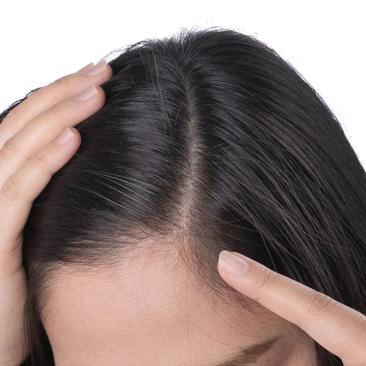 Most Common Causes of Grey Hair (White Hair) & How Can You Reverse It