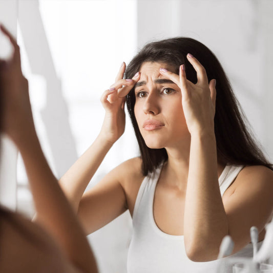 How to Get Rid of Acne Scars and Dark Spots: Best Ingredients That Actually Work