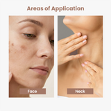 2% Kojic Acid Face Wash for Pigmentation & Dull Skin – 100 g
