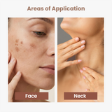 2% Kojic Acid Serum Cream for Dark Spots and Pigmentation - 30gm