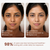 2% Kojic Acid Sunscreen SPF 50+ for Pigmentation and Tanning - 50GM