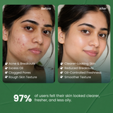 BODYTALES 2% Salicylic acid facewash