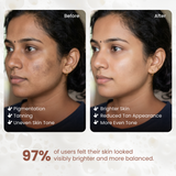 2% Kojic Acid Syndet Soap for Dark Spots and Pigmentation - 75g