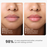 Multi Peptide Lip Balm for Lip Plumping and Hydration – 15 g