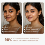 2% Kojic Acid Face Wash for Pigmentation & Dull Skin – 100 g