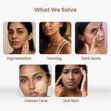 2% Kojic Acid Syndet Soap for Dark Spots and Pigmentation - 75g