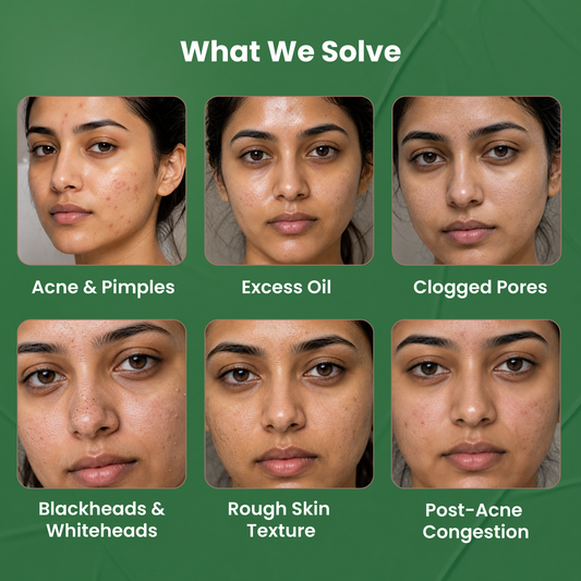 2% Salicylic Acid Face Wash for Acne & Oil Control - 100G