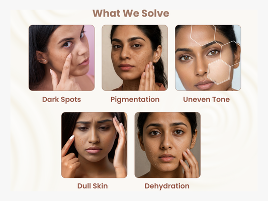 2% Kojic Acid Anti Pigmentation & Tan Protection Combo | Soap (Pack of 1) + Facewash 100g + Serum-Cream 30g + Sunscreen 50g