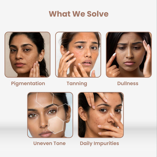2% Kojic Acid Face Wash for Pigmentation & Dull Skin – 100 g
